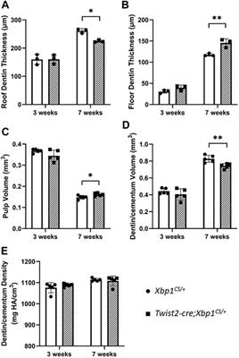 Constitutive expression of spliced X-box binding protein 1 inhibits dentin formation in mice